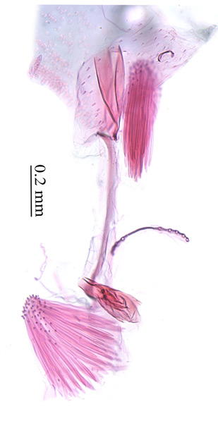/filer/webapps/moths_gc/media/images/P/podocarpa_Phyllocnistis_GM_PT_Liu-et-al_2018b_562_SDNU_corema.jpg