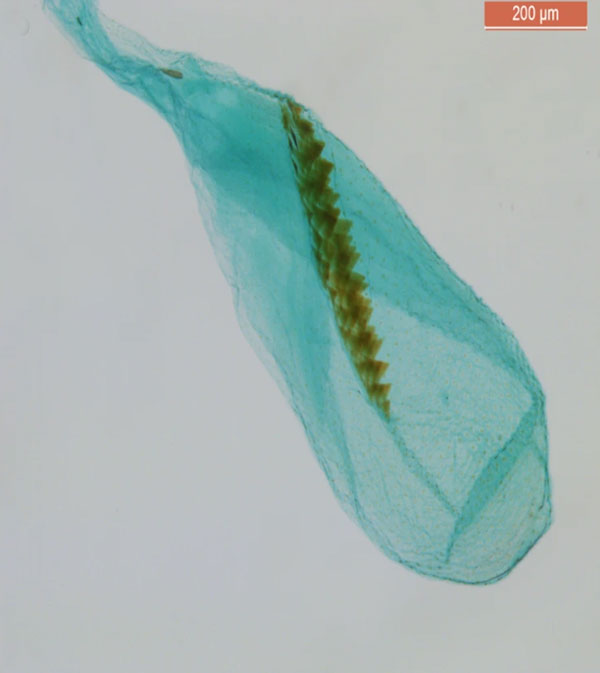 /filer/webapps/moths_gc/media/images/S/sinensis_Conopomorpha_GF_corpus-bursae_Siraj-etal_2026_175.jpg