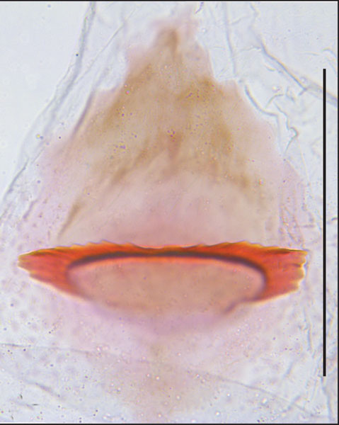 /filer/webapps/moths_gc/media/images/S/socoromaensis_Cremastobombycia_signum_GF_HT_IDEA.jpg