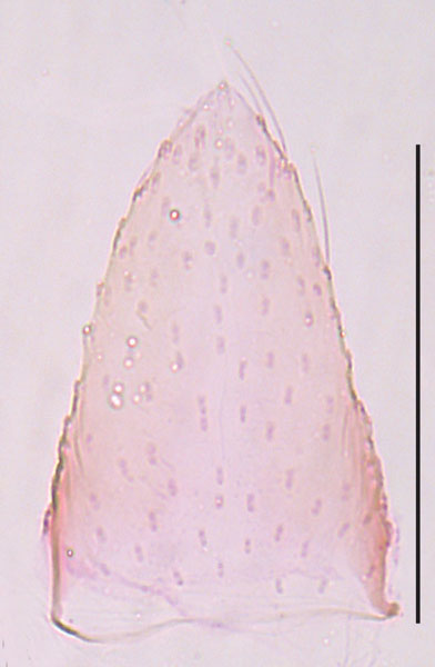 /filer/webapps/moths_gc/media/images/S/socoromaensis_Cremastobombycia_sternum-7_GM_HT_IDEA.jpg