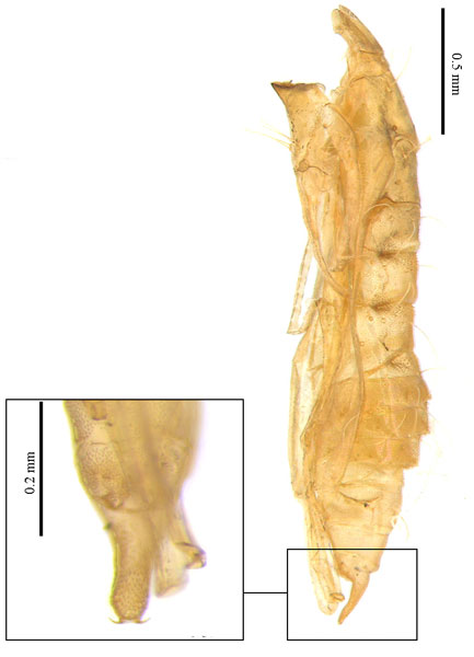 /filer/webapps/moths_gc/media/images/S/stenopterae_Phyllonorycter_pupa_Lu-etal_2025_460.jpg